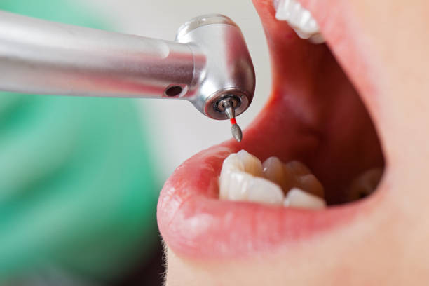 Best Broken or Cracked Tooth Emergency Dentist in Onawa, IA